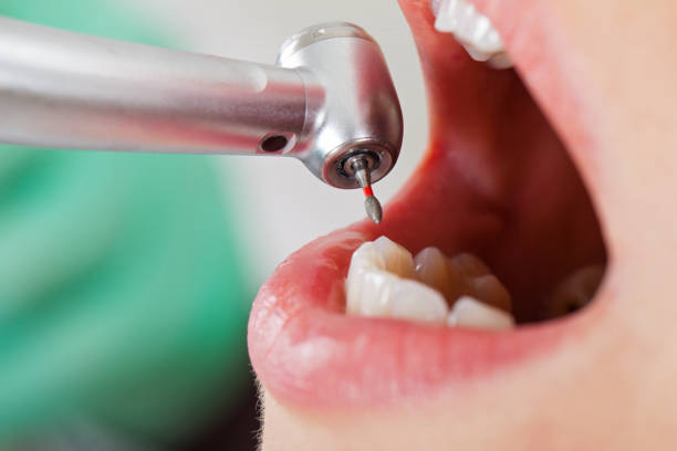 Best Emergency Dental Care for Abscessed Tooth in Weldon Spring, MO